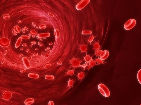 Hội chứng tiêu khối u – Dự phòng và điều trị